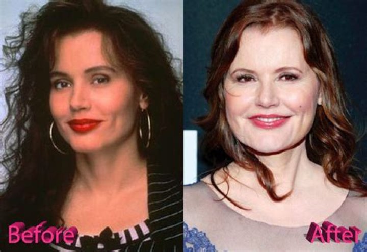 Geena Davis Surgery: The Truth Behind The Rumors